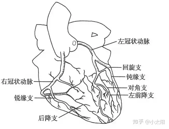 图1 冠脉粥样硬化的病理过程(图片来自网络)1,冠状动脉的应用解剖