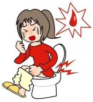 便血的颜色取决于消化道出血的部位,出血量与血液在