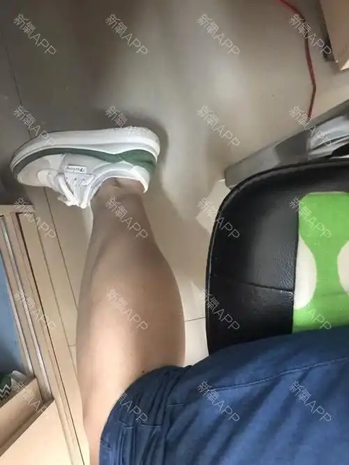 身高161cm,体重104,但是小腿真心结实,不使劲腿围35cm,小腿用力36cm