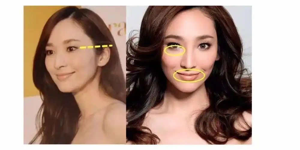 吴小姐的鼻子在面相中属于"孤峰鼻",鼻子轮廓大而无肉,欠缺柔和,对