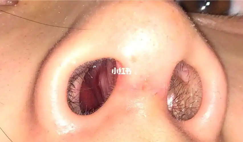 嗅鼻子的时候小的鼻孔直接堵住了.