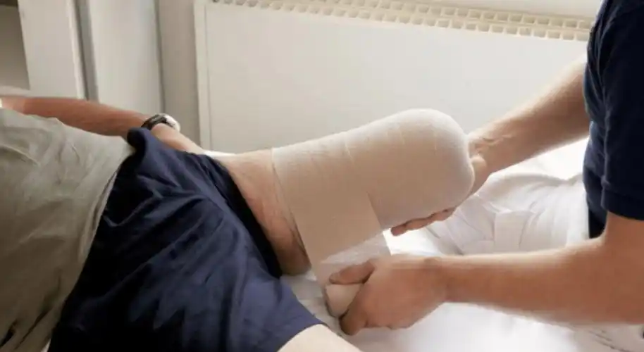 新截肢患者常问的一些问题