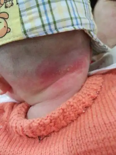 是不是热的?后脑勺的地方!