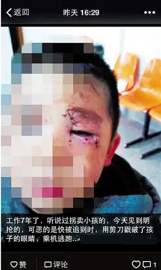 狠妇光天化日抢孩子 未得逞竟用锐器猛戳其眼睛