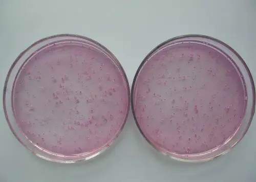 在孟加拉红培养基上霉菌和酵母菌的形态是什么样的