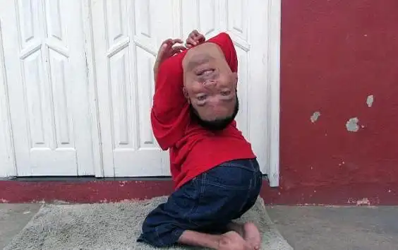 他一出生头就倒挂着,却活出了别样的人生