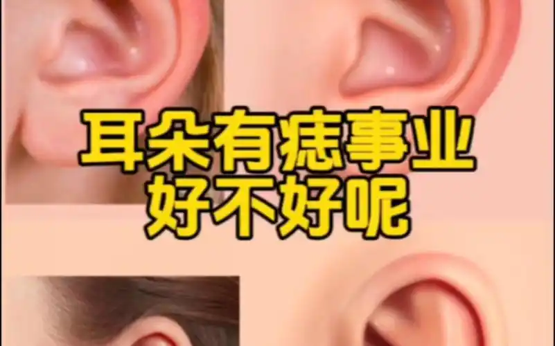 耳背后面长痣图解面相_耳朵长在后面的财运_耳后背长痣好不好