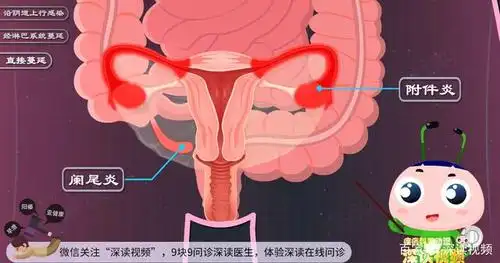 附件炎咋来的?性生活过频,人流惹的祸?硬核干货教你科学预防