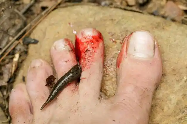 童年那些事蚂蟥身上滴风油精火烧毛毛虫老鼠嘴里塞鞭炮