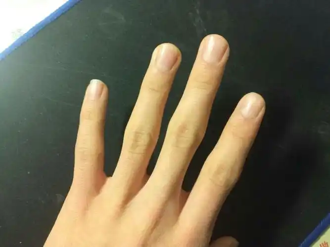 5cm 食指是9.3cm 中指是11cm 无名指1