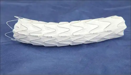 黄乐刚:先健胸主动脉覆膜支架经验分享·365医学网