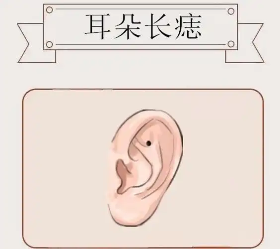 而一般在耳朵的位置处长有吉痣,则这样的人,天生的福碌与财碌发展都会