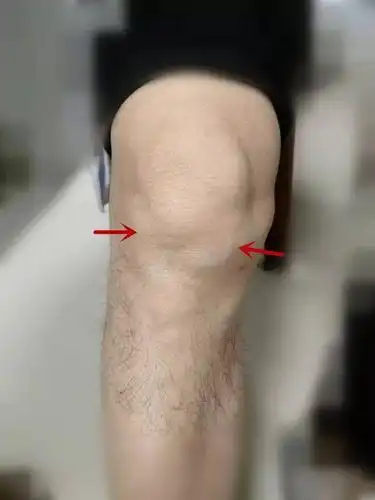 早晚天冷了,骑电动车千万要注意保护膝盖