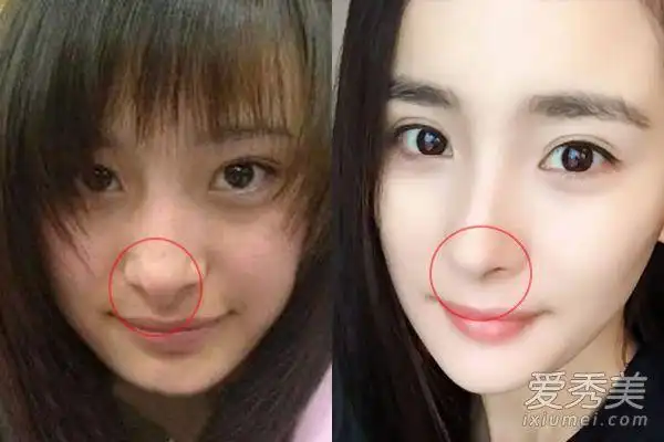 技术贴:全方位分析杨幂到底整了哪里? 杨幂整容前后照片