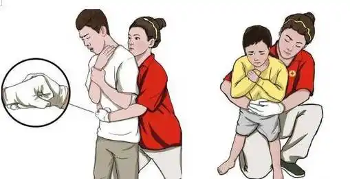 坐位施救如果患者处于坐位,施救者只需弯下腰,采用和站立位完全相同的