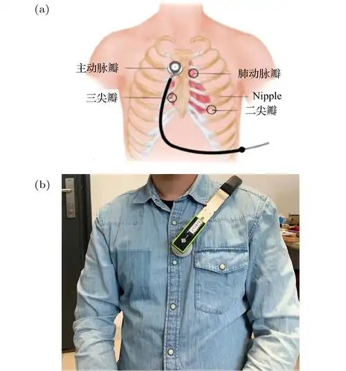 blood pressure estimation based on heart sound signals