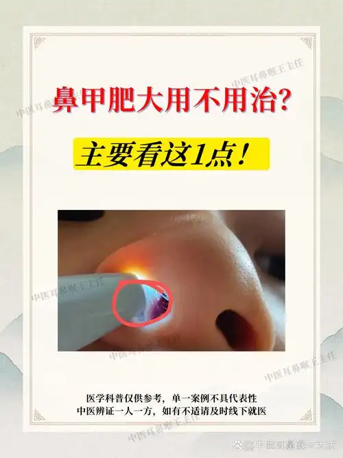 孩子鼻塞,鼻甲肥大要不要治?