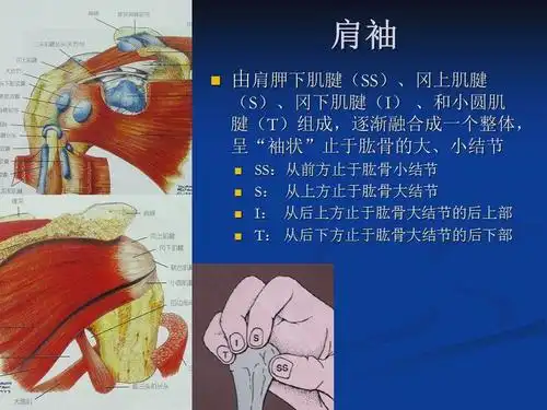 19.5.31～肩袖撕裂的影像评论