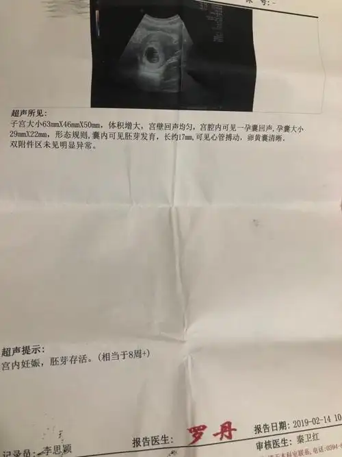 孕十周彩超,是男是女啊!怀孕十周.