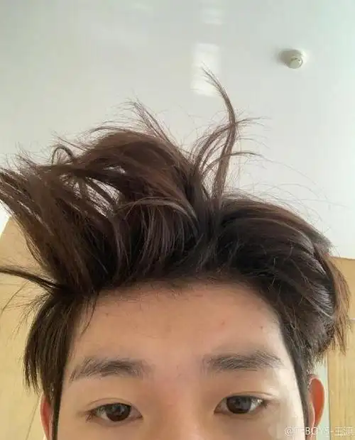 毫无偶像包袱!王源顶鸡窝头晒自拍 额头痘痘很明显