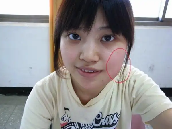 有点痛,直到右下智齿带着半个脸都肿了,我也没想着去拔掉它,去在药店