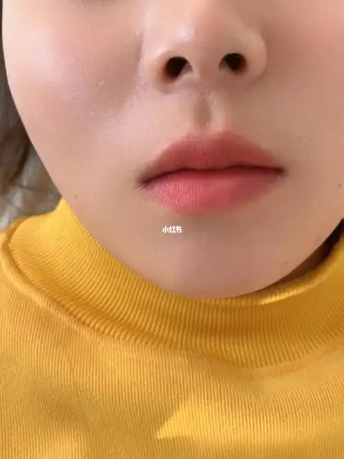 纹唇一个半月后