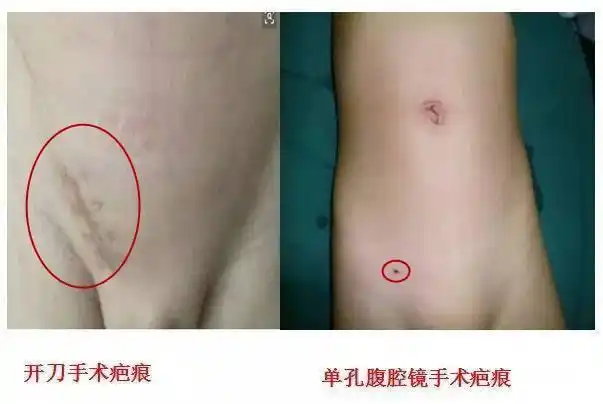 家有男宝宝孩子出现这个症状别大意