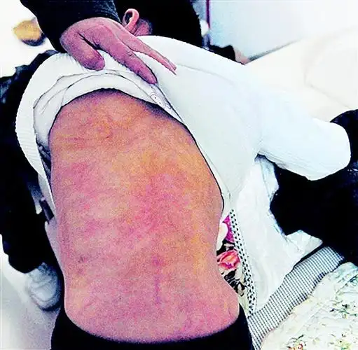 南京暴打男童养母被刑事拘留