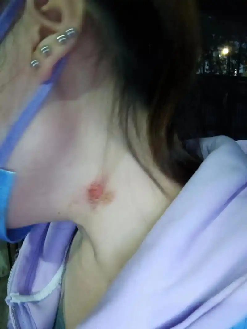 最近有很多朋友问我,我脖子上咋弄个草莓,我告诉你们,我脖子从 - 抖音