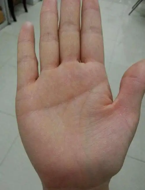 断掌是什么意思 (断掌是什么意思断掌的男孩命运好不好)-第2张图片-珑