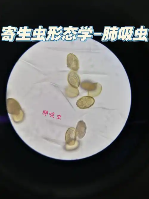 寄生虫形态学肺吸虫