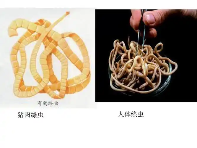 猪肉绦虫 人体绦虫