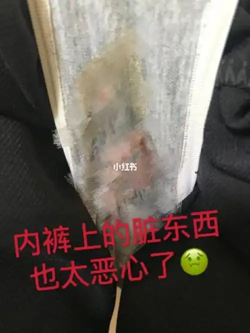 恶心恶心妇科炎症这辈子都不想再见了