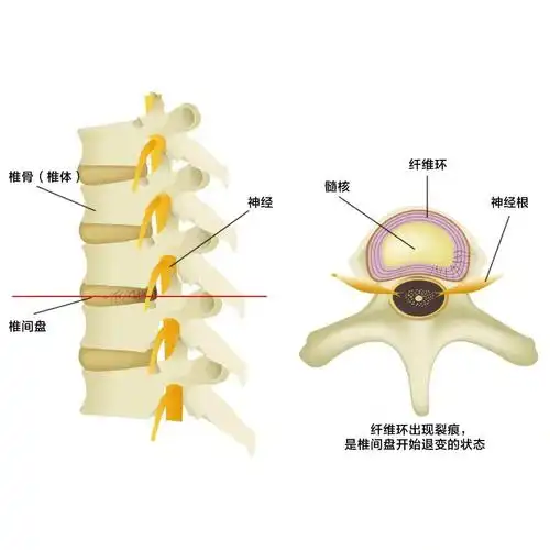 凭什么可悦龄可以治愈腰椎间盘突出?