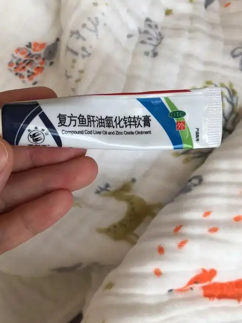 宝宝红屁股篇告别红屁屁