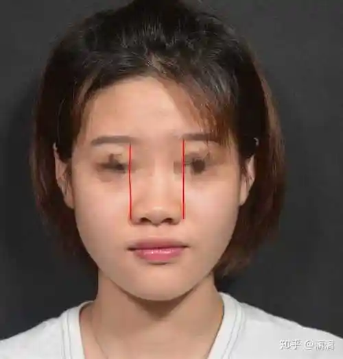 塌鼻子面相分析面相 塌鼻子面相不好吗