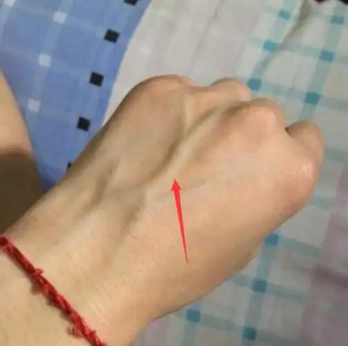 手背"青筋"变粗?医生提醒:"它"的暗号,八成人还完全不知道