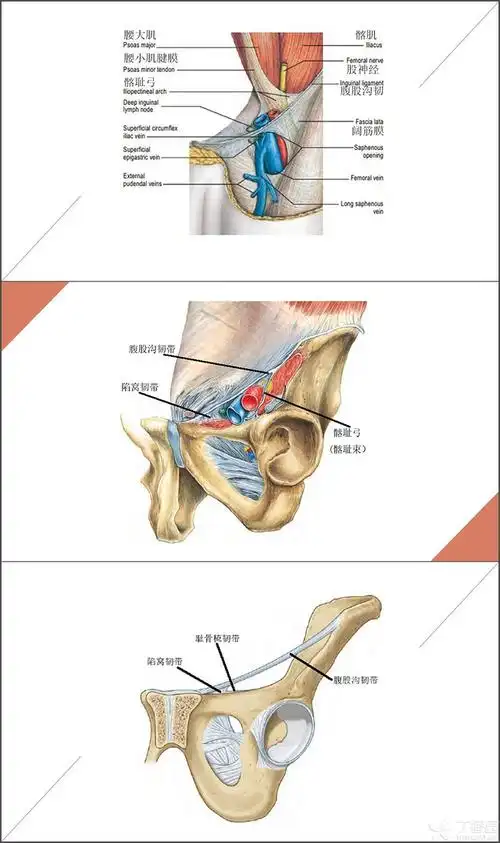 【求助】求解 腹股沟区 耻骨梳韧带与 髂耻束 的详细图解
