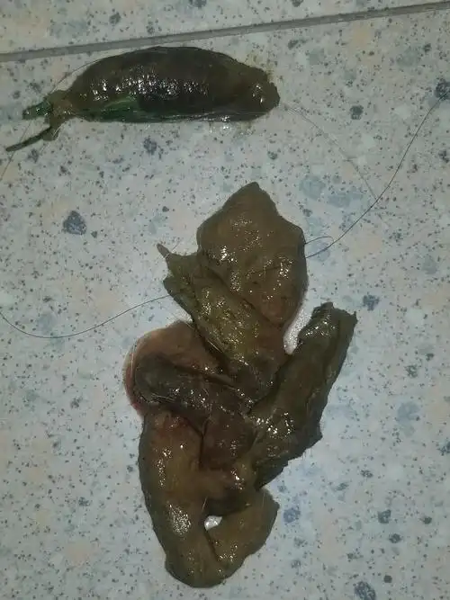 【讨论】一直软便带血治不好咋整,快疯了!有屎图,慎入