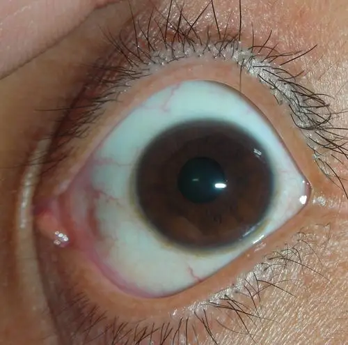 快来看这吓人的眼睛