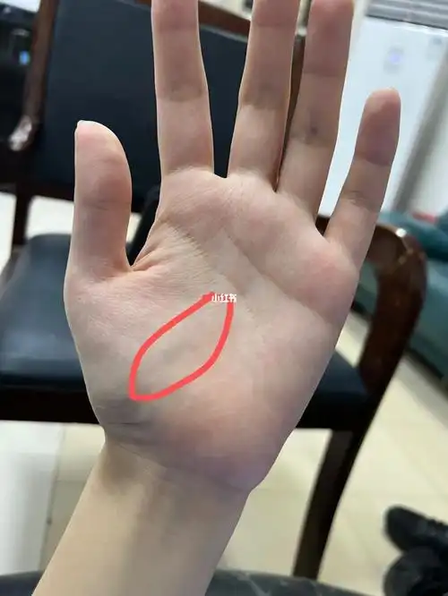 左手大鱼际青筋凸起自我治疗之路