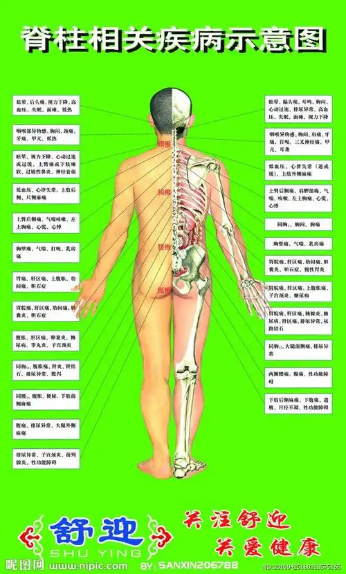 脊柱相关疾病示意图源文件