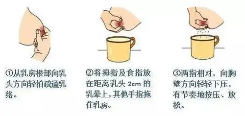 母乳喂养常见问题二产后涨奶怎么办