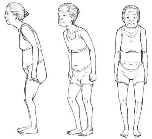5个动作告别虎背熊腰30天练就迷人美背杀打卡07