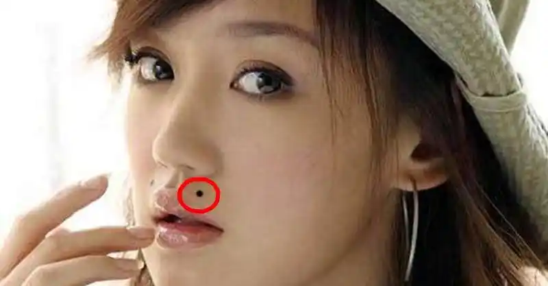 嘴边这「三个地方」长痣的人,男富女贵,名利双收!快看看