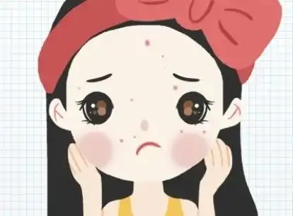 额头眉心长痘怎么治疗2