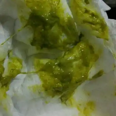 请问这种大便正常吗?两个月纯母乳餵养,颜色很绿._宝宝树