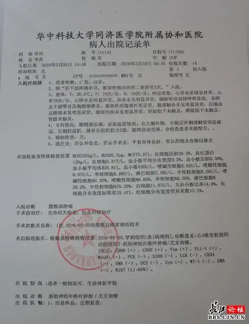 黄陂十岁男童患罕见脊椎肿瘤坐着睡觉