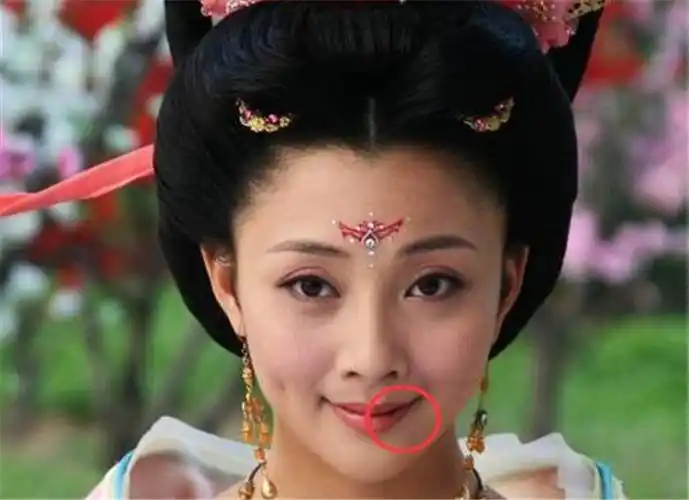 殷桃的嘴怎么总是破的殷桃嘴唇上的痣显突兀令其烦恼不已