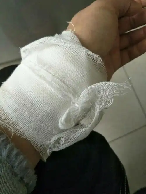 图片真实照片女生自残手腕包扎图片自残包扎完伤口的照片自残的照片